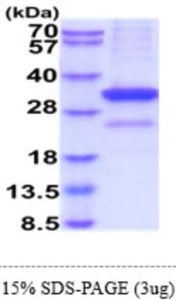 Novus Biologicals Recombinant Human MBL-2 Protein 100 &mu;g | Buy Online | Novus Biologicals&trade; | Fisher Scientific
